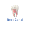 Root Canal