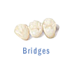 Bridges